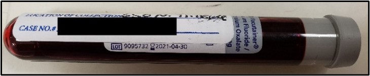 Example of a specimen tube that has the lot number and expiration date visible, and the tube stopper not taped. This is the preferred condition to submit a blood specimen inside a properly sealed DUI/DUID Blood Draw Kit (provided).